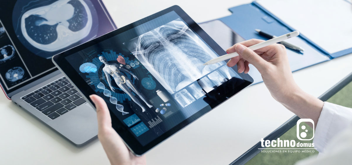 La tecnología en el cuidado de la salud: relevancia de la radiología y las imágenes médicas Imagen médica de rayos X del pecho para el diagnóstico preciso de enfermedades